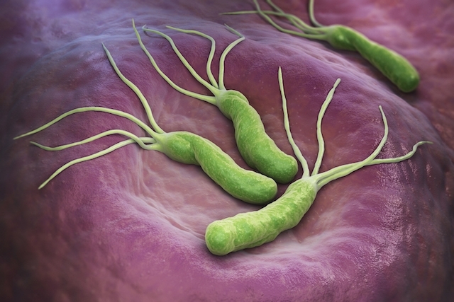 Helicobacter Pylori - Diario Puerto Varas