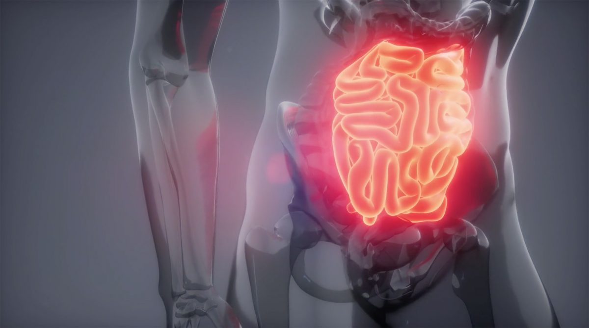 Sociedad Chilena de Gastroenterología - Cáncer digestivo - Diario Puerto Varas